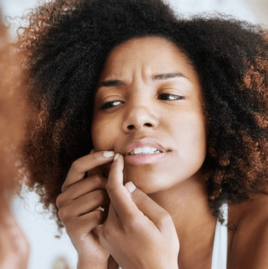Hormonal Skincare Tips