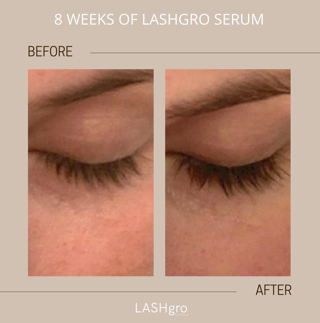 Lash growth serum results