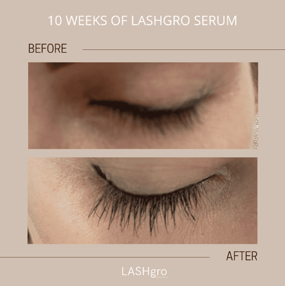 lash growth serum